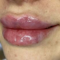 Косметология. Full Face, Софрино