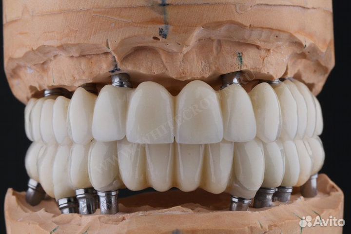 Зубные протезы. Циркон. Коронки и мосты