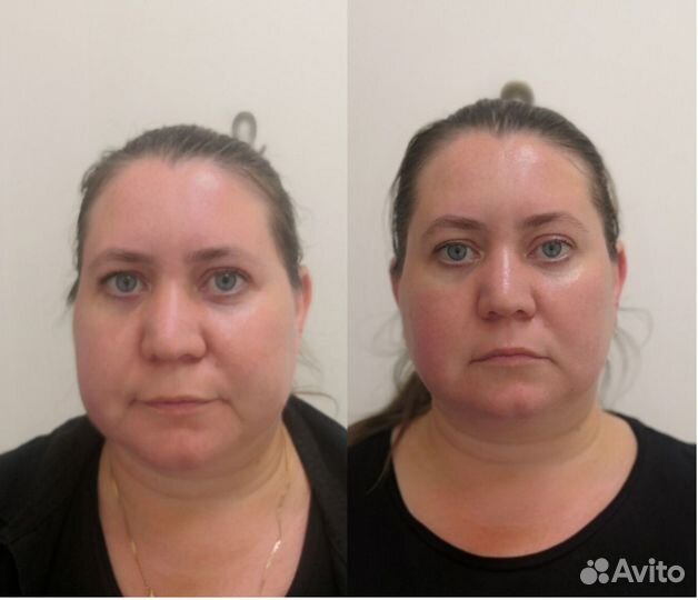 Массаж, чистки, пилинги, аппаратная косметология