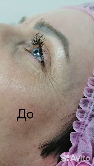 Услуги косметолога