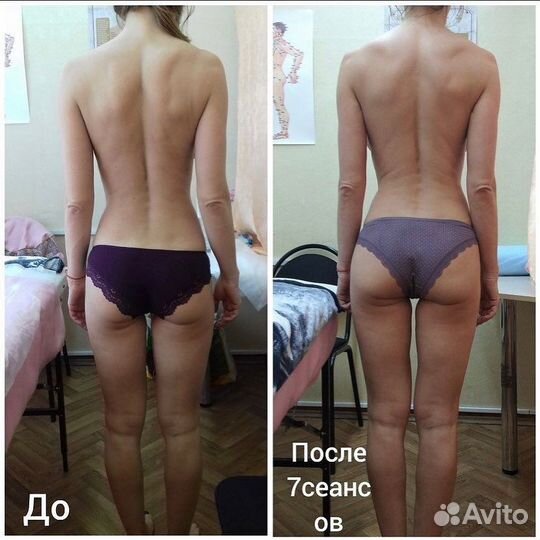 Ищем Модель - Спортивный массаж