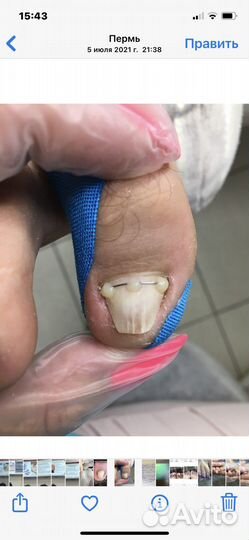 Услуги подолога