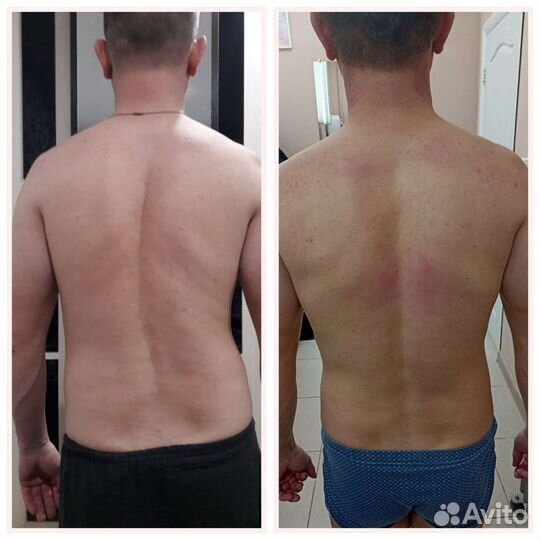 Массаж костоправ Оздоровительный массаж