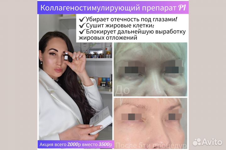 Косметолог уберу брыли