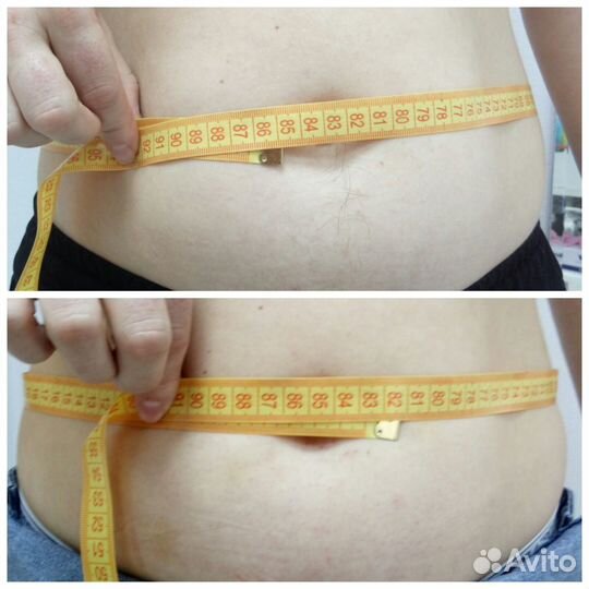 Похудение. Безоперационная липосакция. Целлюлит