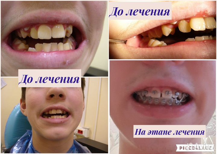 Врач стоматолог ортодонт