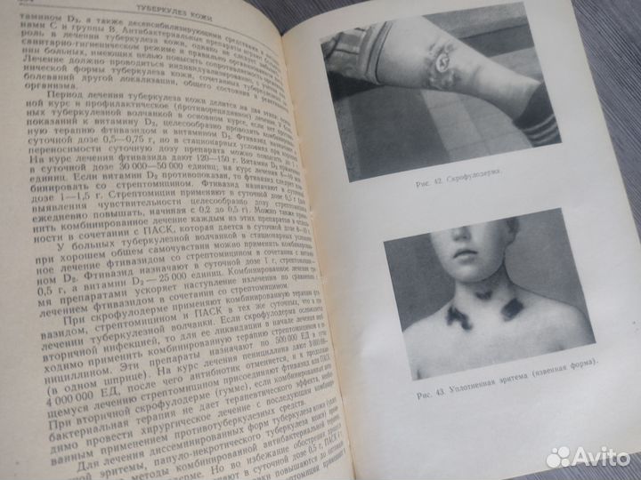 Книга по медицине Справочник фтизиатра