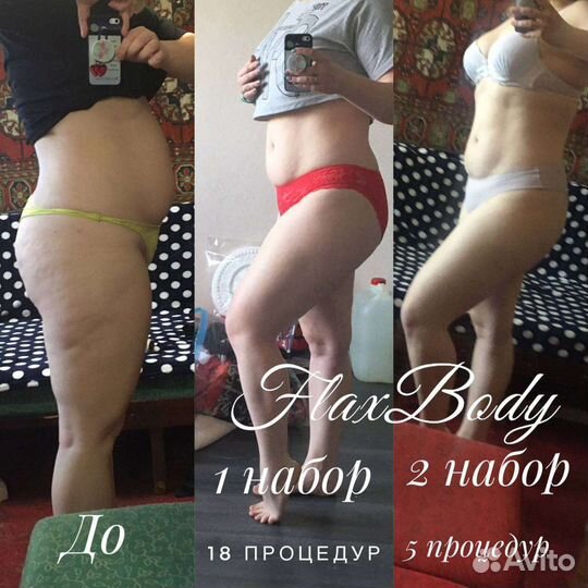 Профессиональная антицеллюлитная система