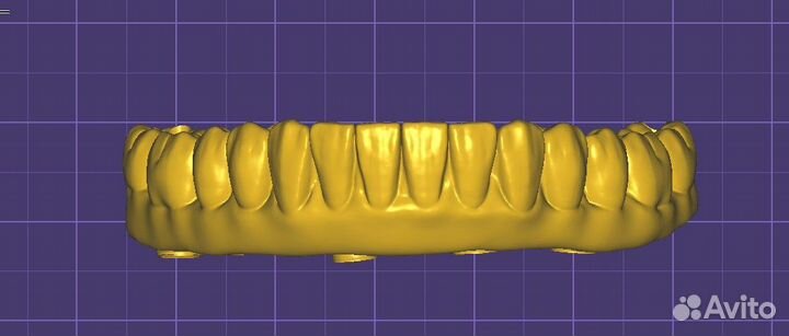 Зубной техник cad Cam