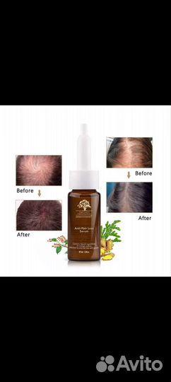 Масло против выпадения волос имбирное
