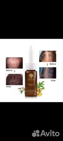 Масло против выпадения волос имбирное