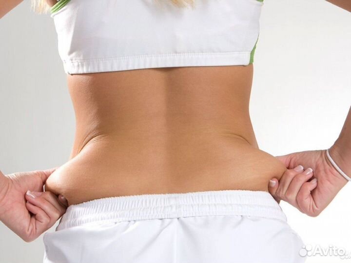 Криолиполиз в Красноярске