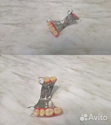 Ремонт зубных протезов