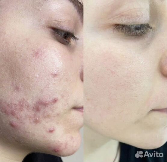 Обучение, практика для косметологов