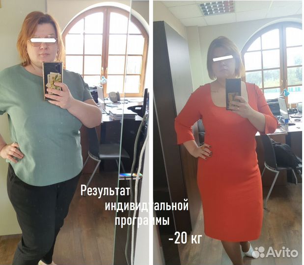 Коррекция фигуры (аппаратная:LPG,Turbo и много др)