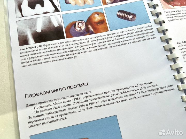 Устранение осложнений имплантологического лечения