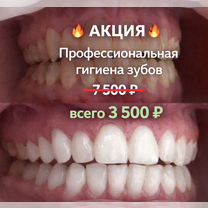 Чистка зубов, Москва
