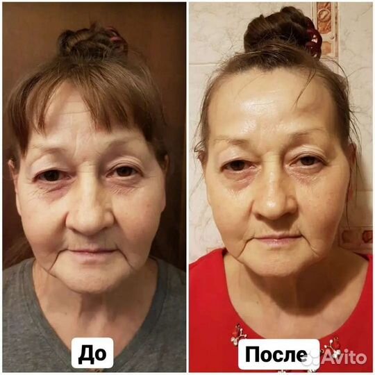 Массаж, кавитация, RF лифтинг, вакуум, вибромассаж