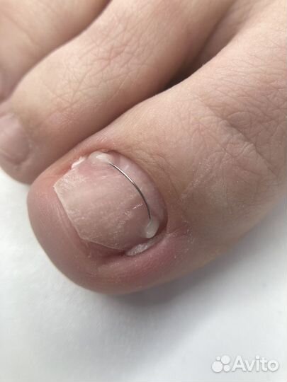 Модель на титановую нить (педикюр)