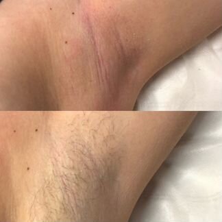 Шугаринг, Маникюр, Педикюр